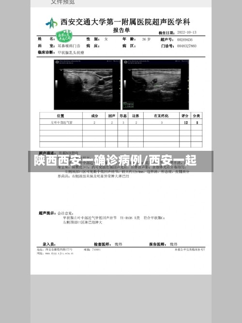 陕西西安一确诊病例/西安一起-第3张图片