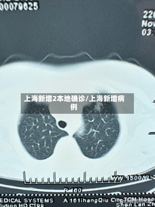 上海新增2本地确诊/上海新增病例