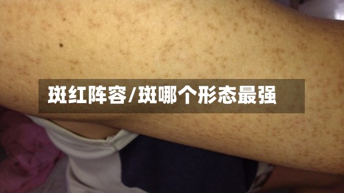 斑红阵容/斑哪个形态最强