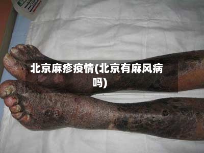 北京麻疹疫情(北京有麻风病吗)