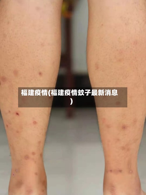 福建疫情(福建疫情蚊子最新消息)-第3张图片