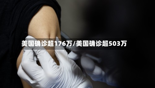 美国确诊超176万/美国确诊超503万-第2张图片